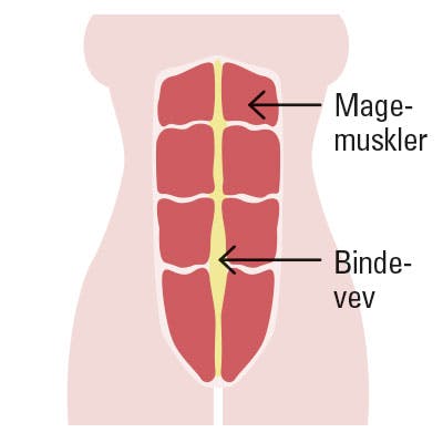 Tegning av vanlige magemuskler