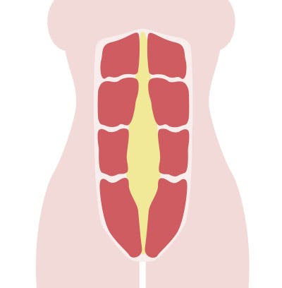 Piirros vatsalihasten erkaumasta