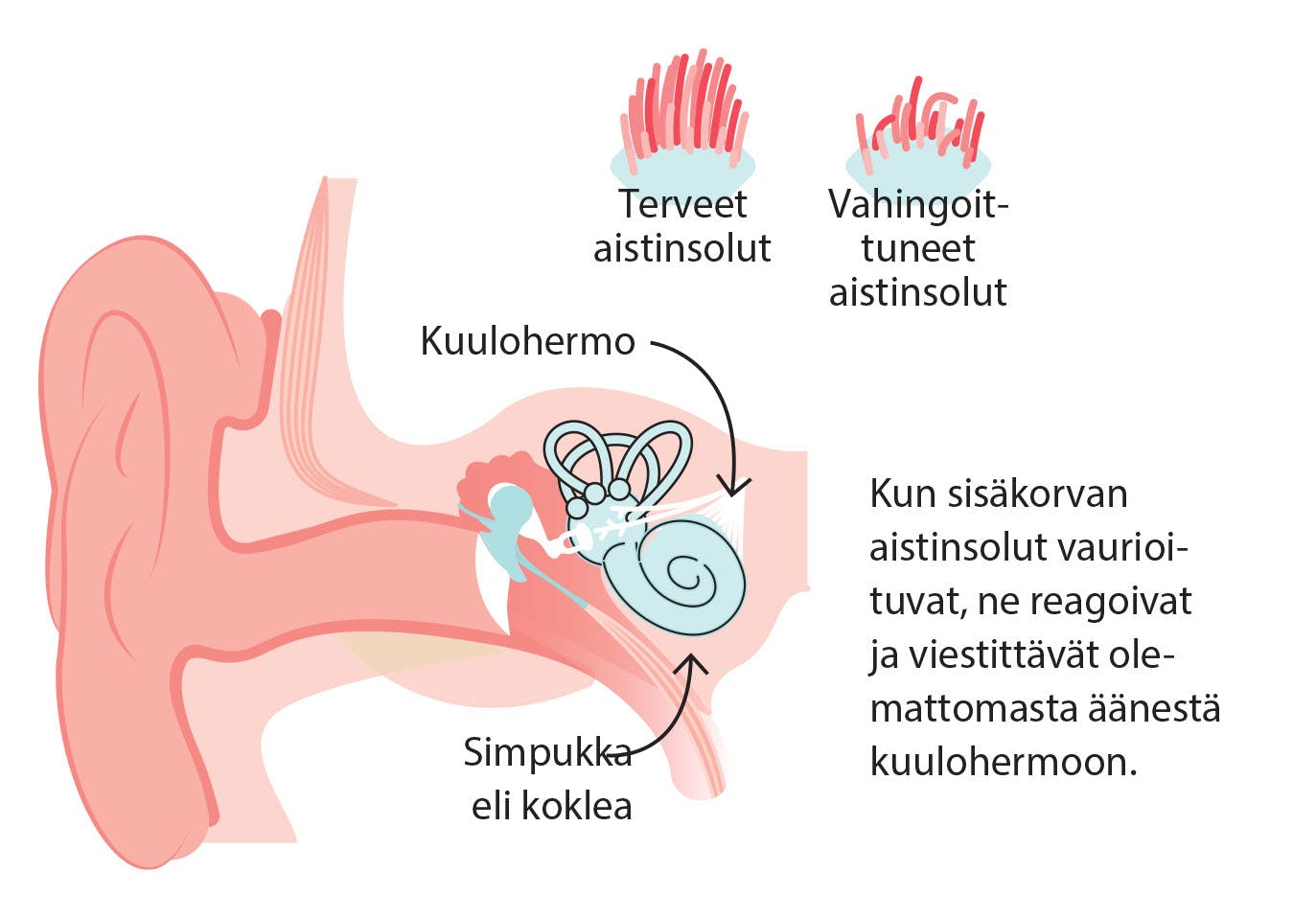 Syy siihen, että korvat soivat