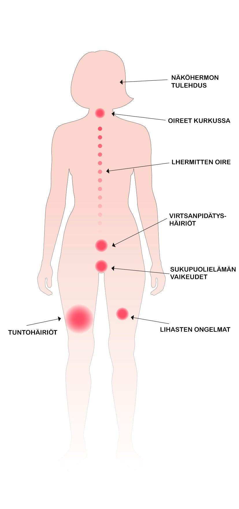 Kuva MS-taudin oireista