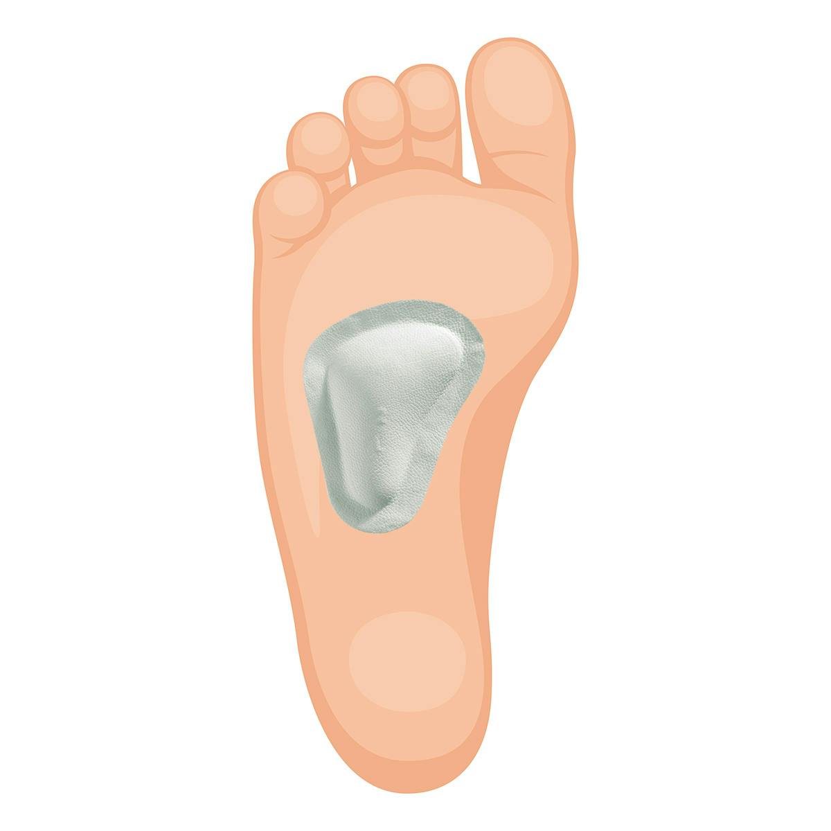 En fotsåle med innlegg under