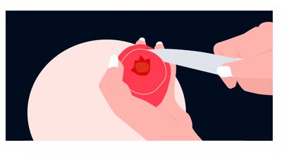 Grafikk av et granateple der toppen skjæres av