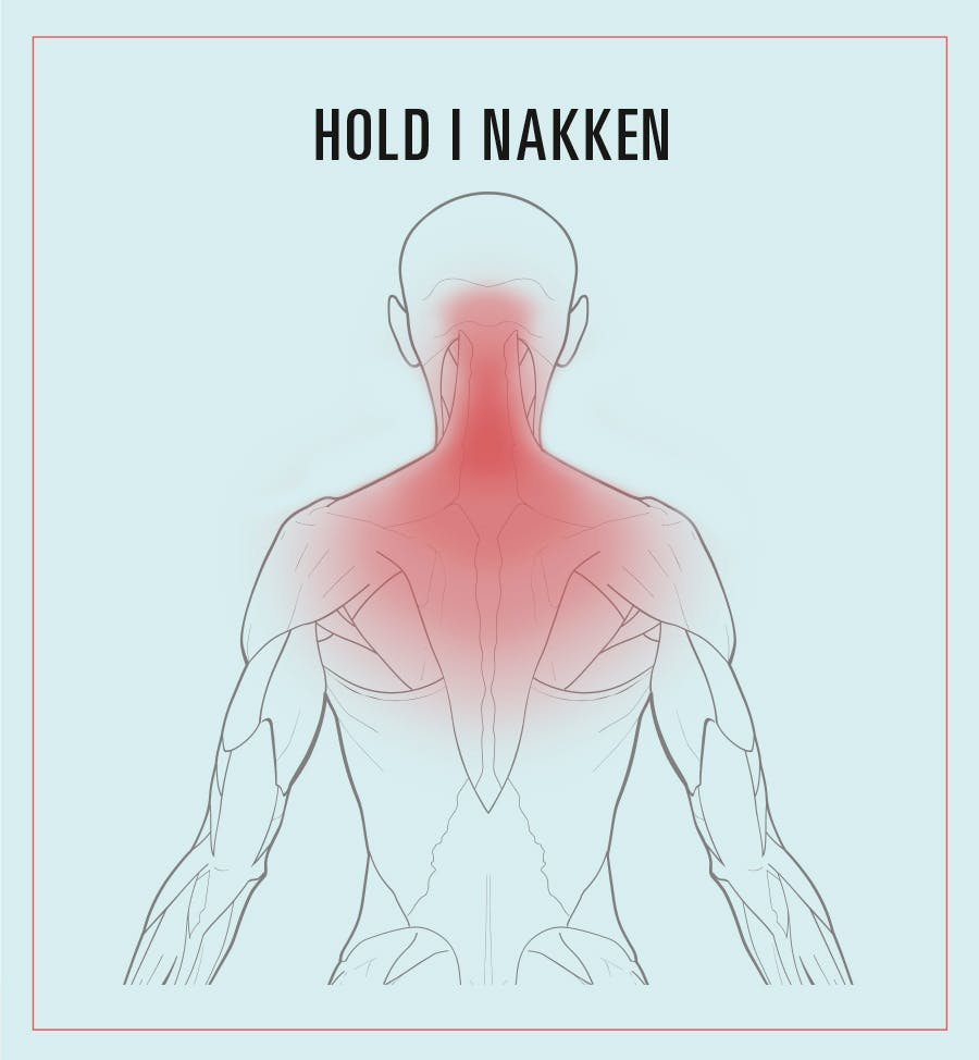 Illustration af smerter ved hold i nakken