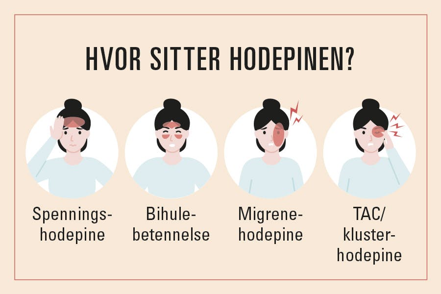 illustrasjonen viser hvor hodepinen sitter