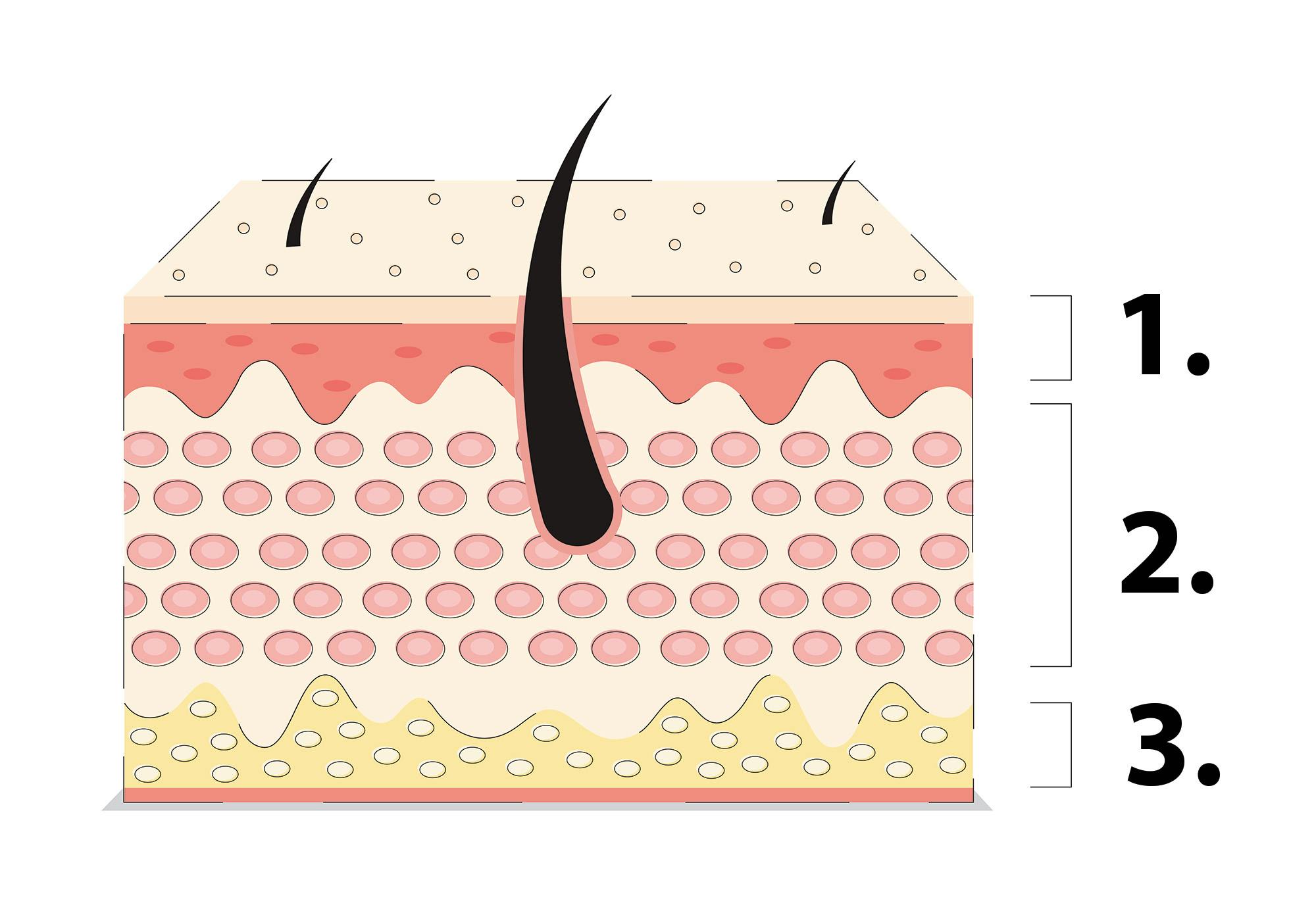 Illustration av hudens lager.