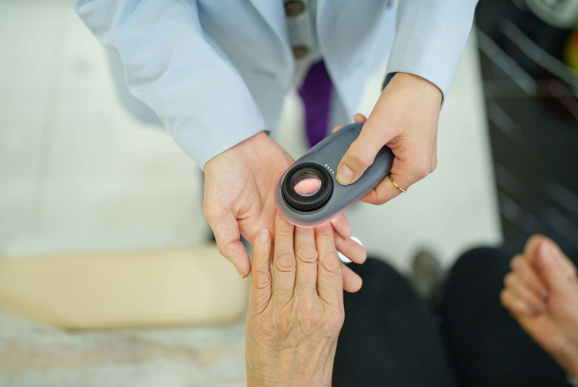 Dermatolog undersöker kvinnors naglar för sjukdomar