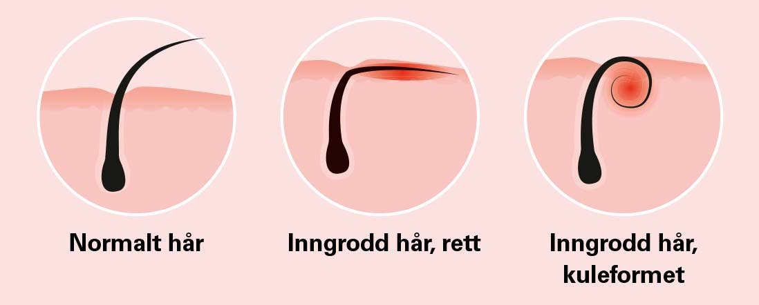 Grafikk av tre slags hår