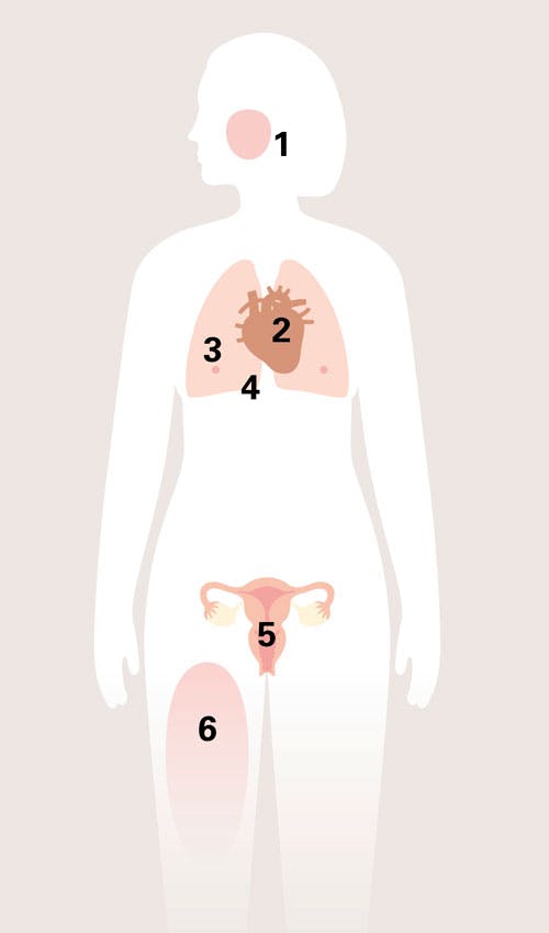 Grafik over kvindekroppen med fremhævede punkter, der påvirkes under en orgasme.