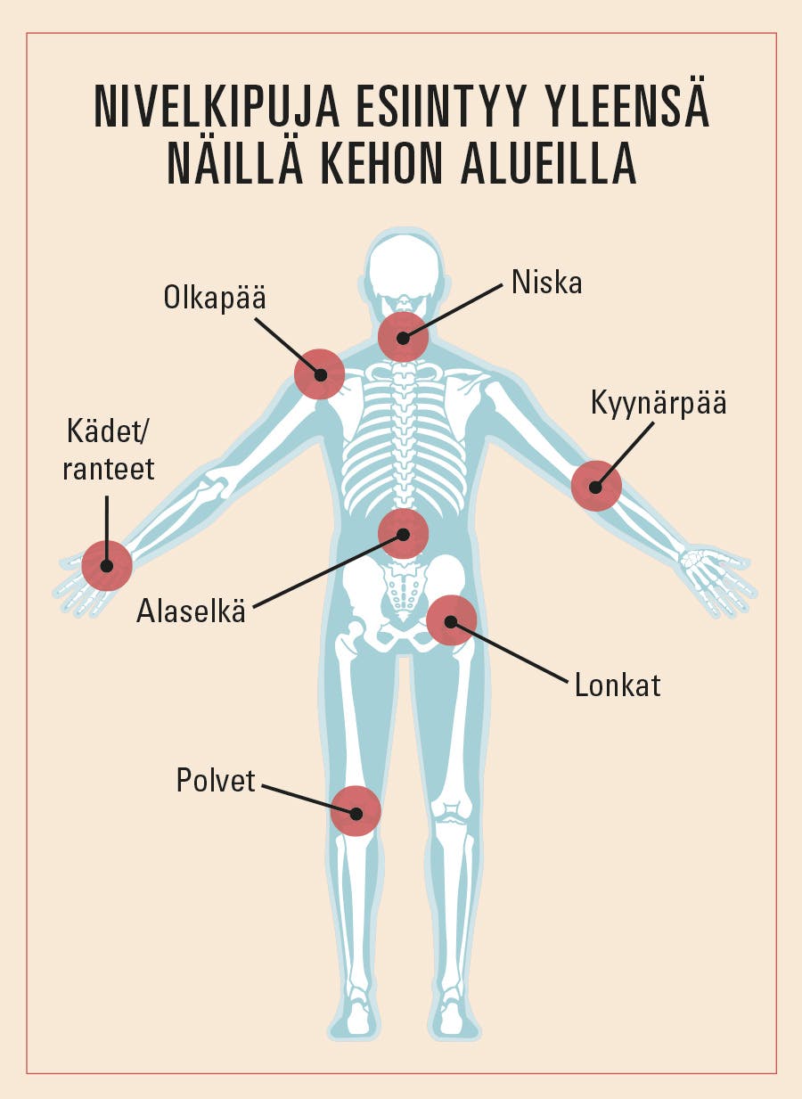 Erilaiset nivelkivut kaaviokuvassa