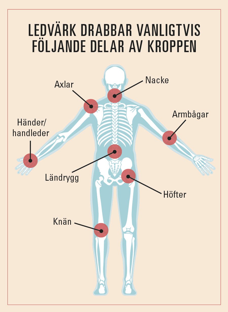 typer av ledvärk illustration