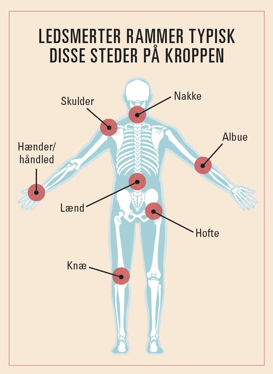 illustration der viser steder, man typisk rammes af ledsmerter