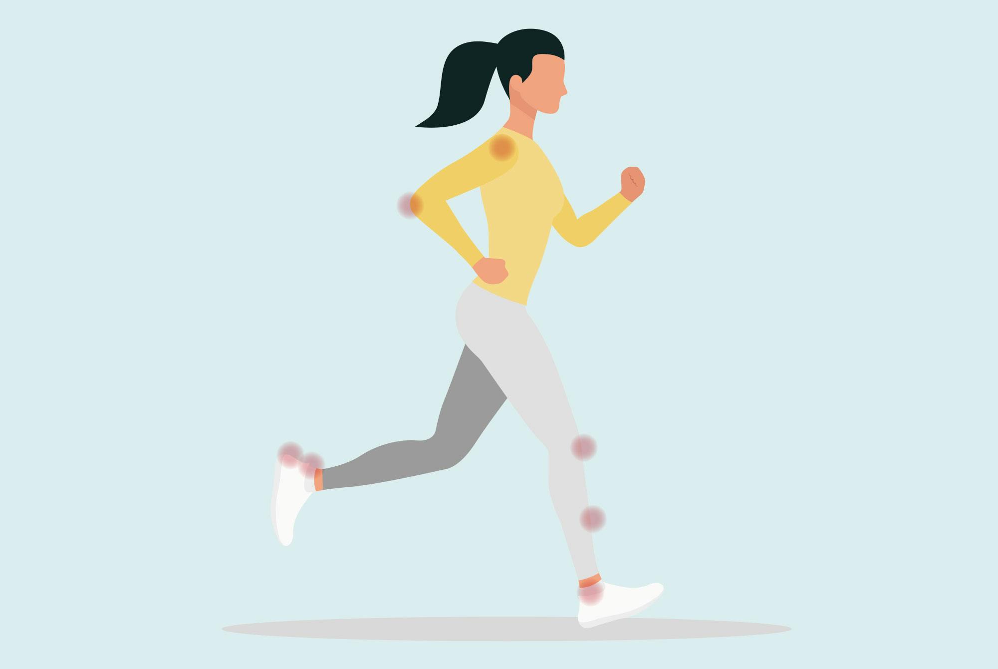 Grafik, løbende kvinde med punkter for overbelastning af bindevæv