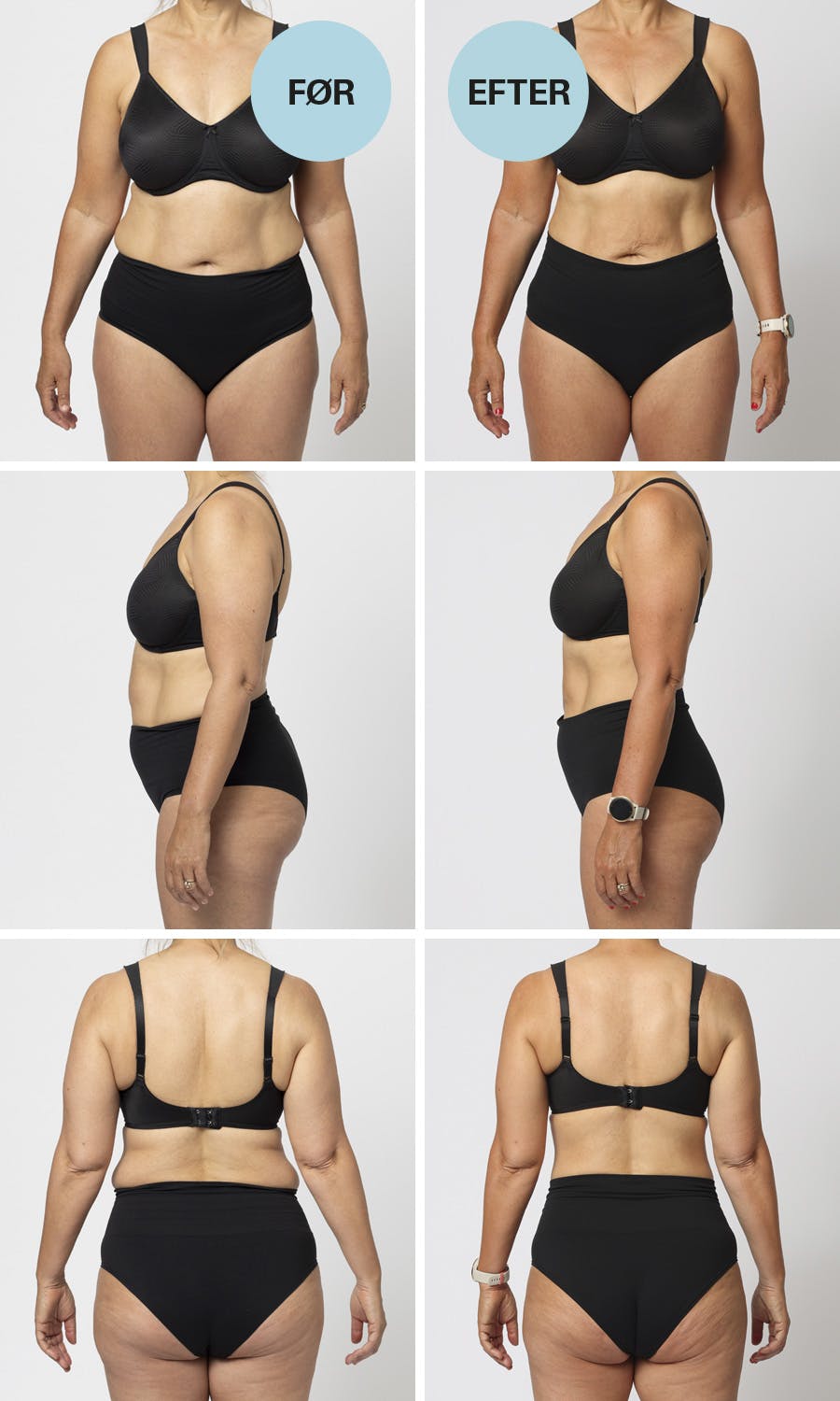 Før- og efterbilleder af Louise, som har fulgt I FORMs kostplan