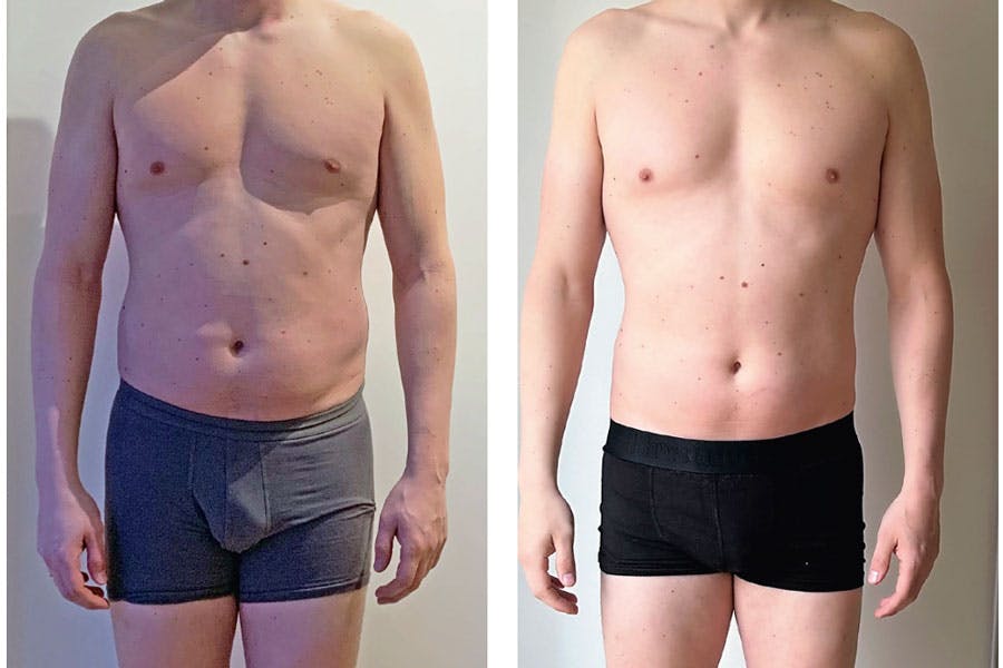 Mads före och efter