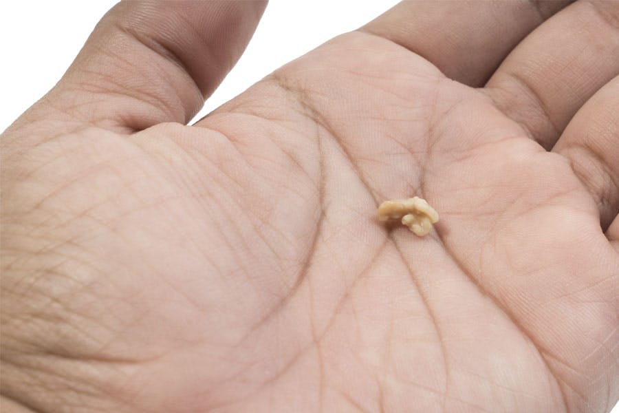 Proppu kädessä - proput