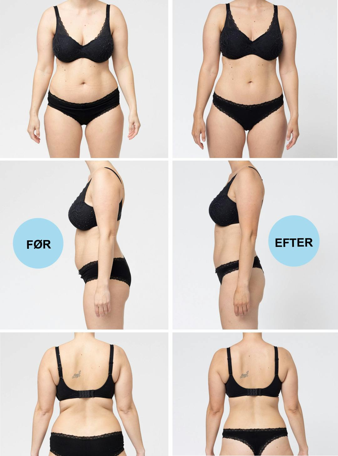 Før efter fotos af case Maria