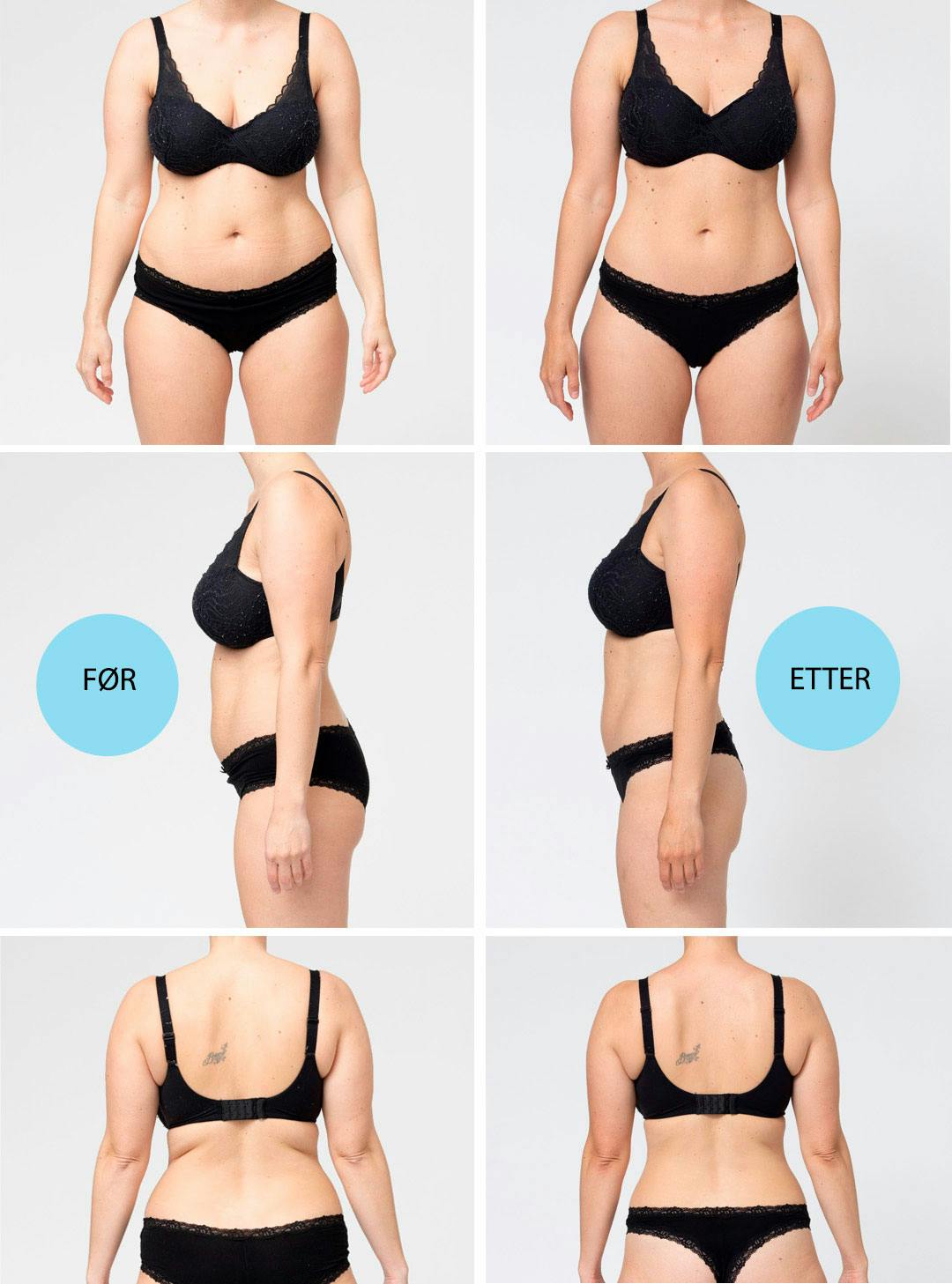 Før- og etterbilder av case Maria