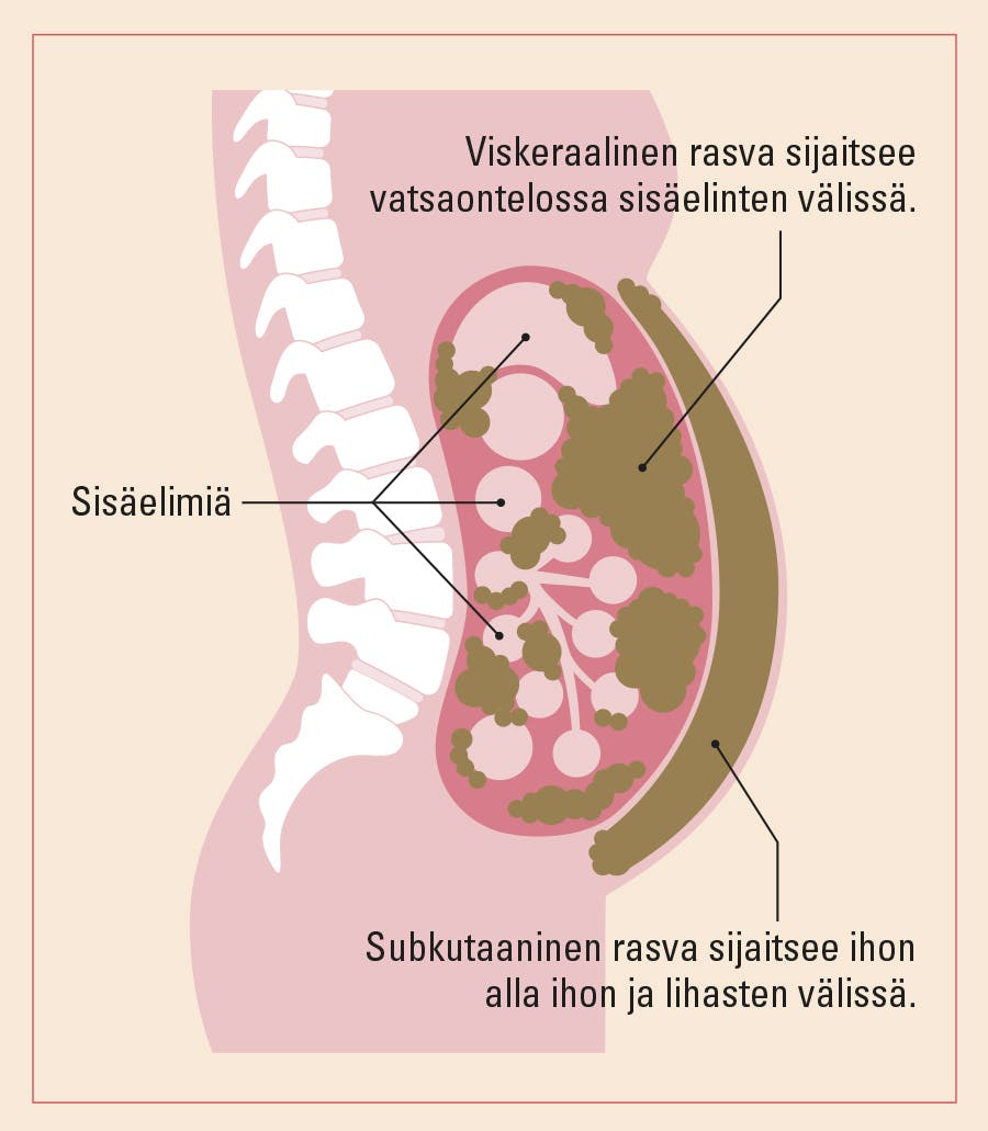 kuvassa näkyy sisälmysrasvan ja ihonalaisen rasvan eli viskeraalisen ja subkutaanisen rasvan jakautuminen.