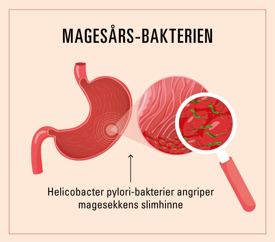 helicobacter pylori symptomer