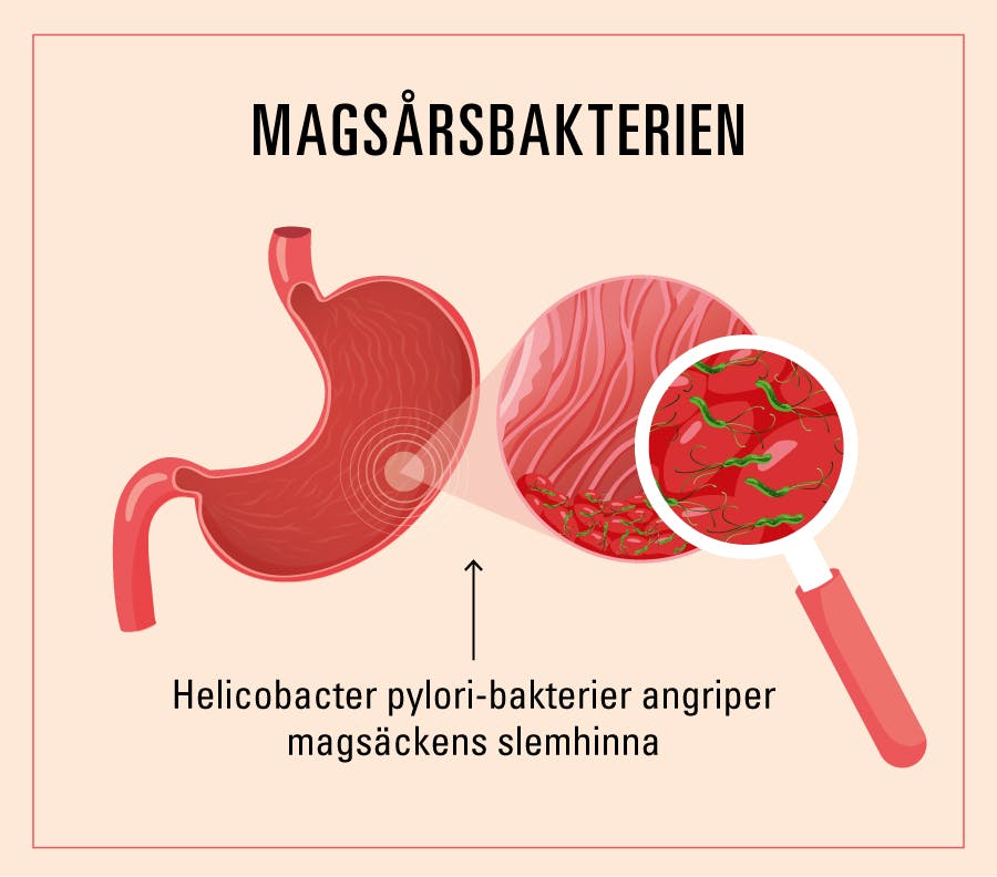helicobacter pylori symptom
