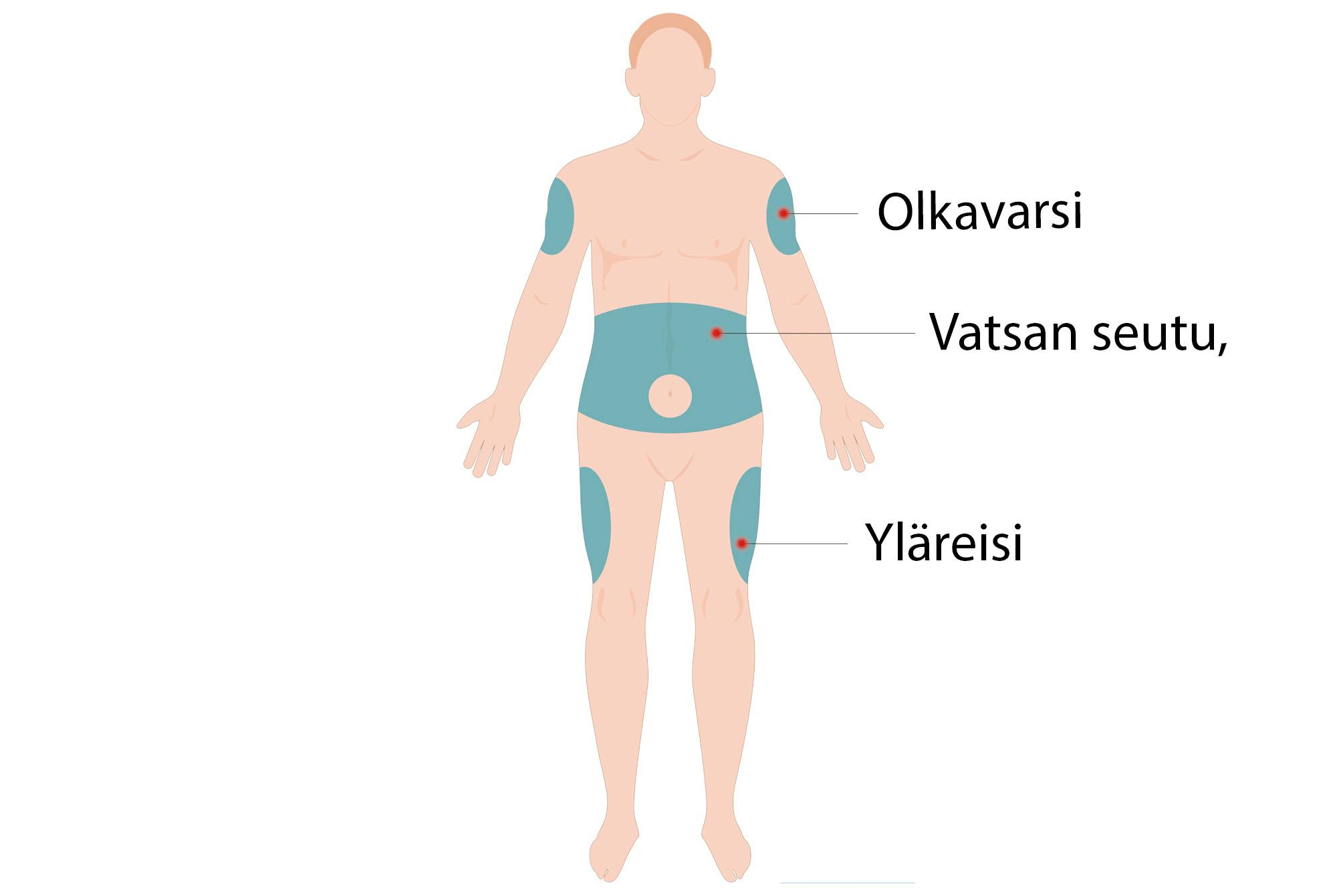 Kuva Mounjaro pistoskohdat
