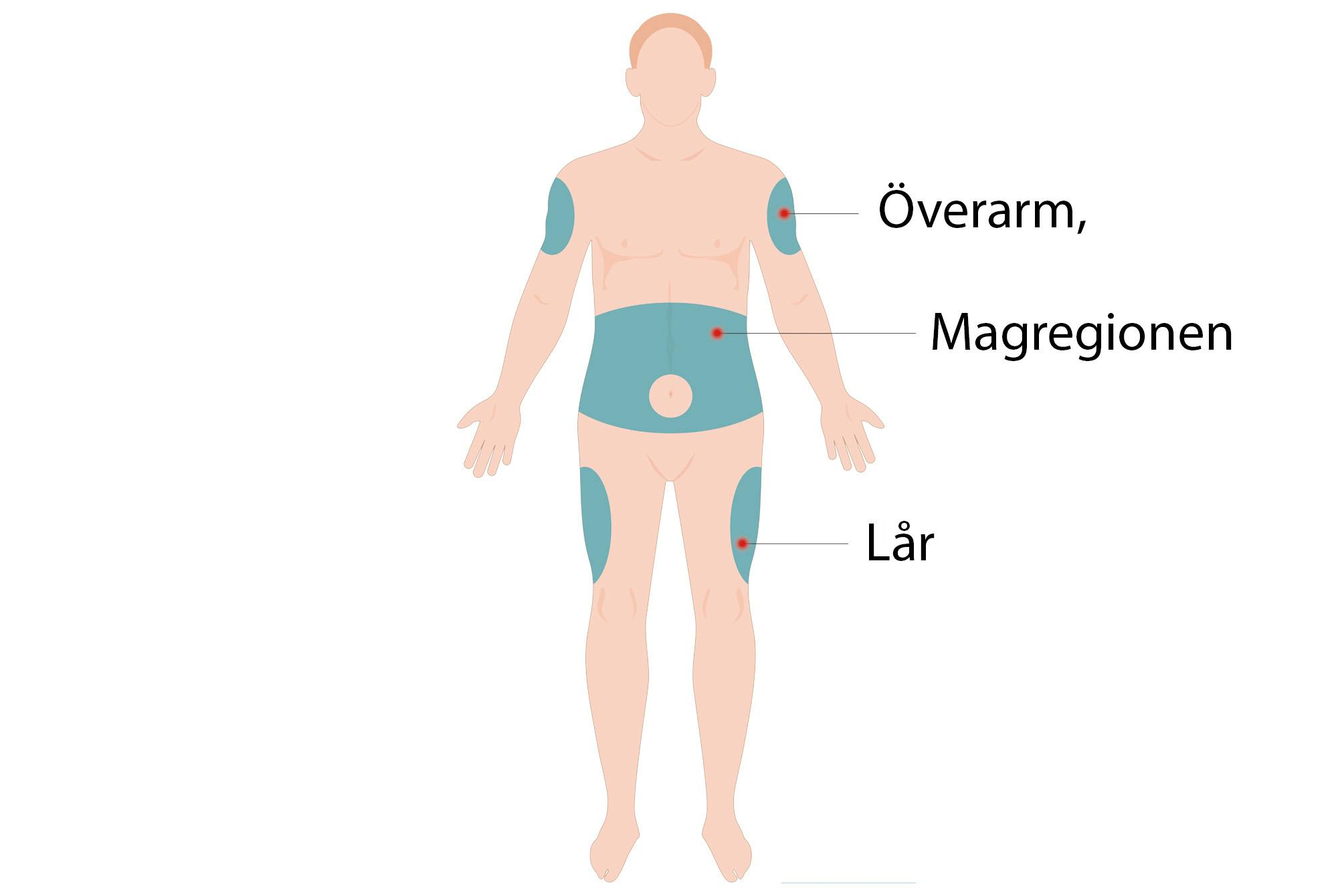 Figur Mounjaro injektionsställen