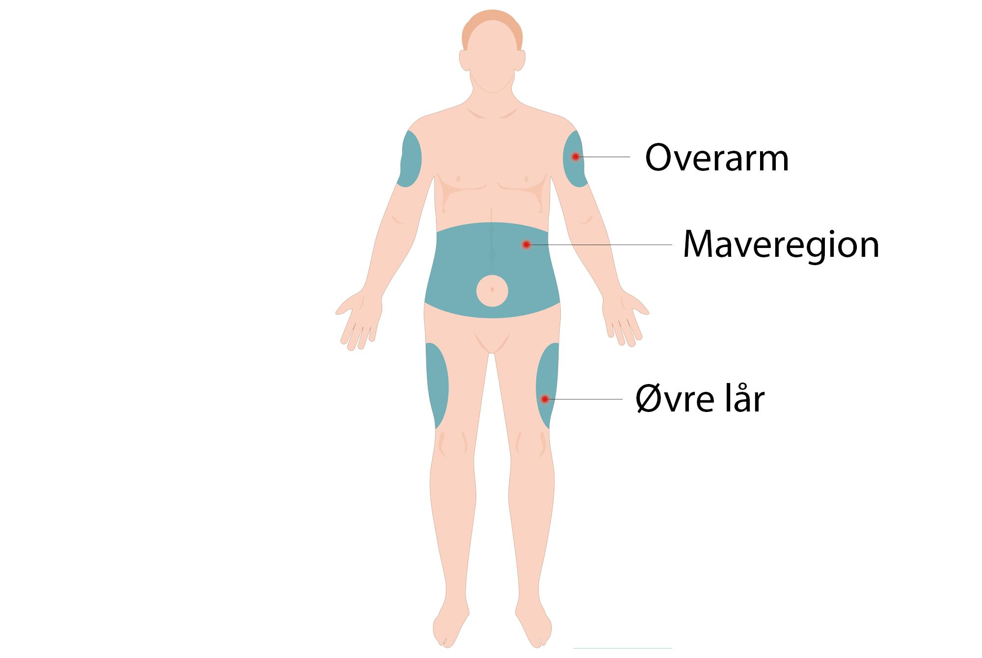 Figur Mounjaro injektionssteder