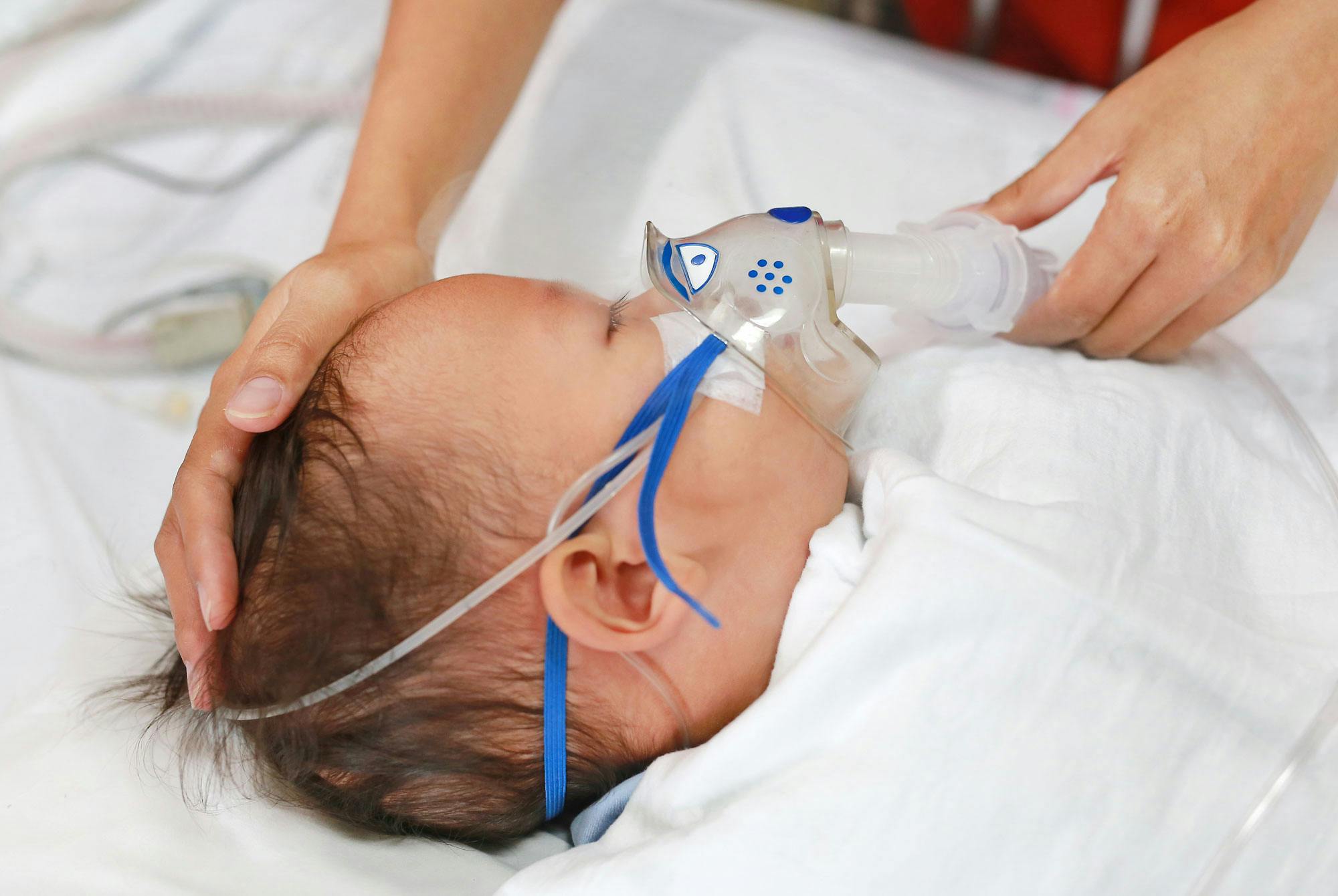 Baby med virusfår iltmaske på