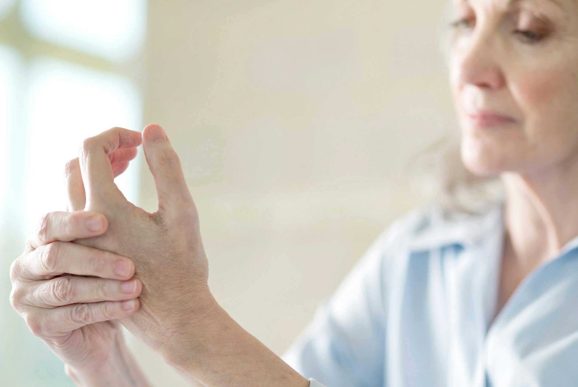 Kvinde holder sig til hænder, hvor hun har fået urinsyregigt.