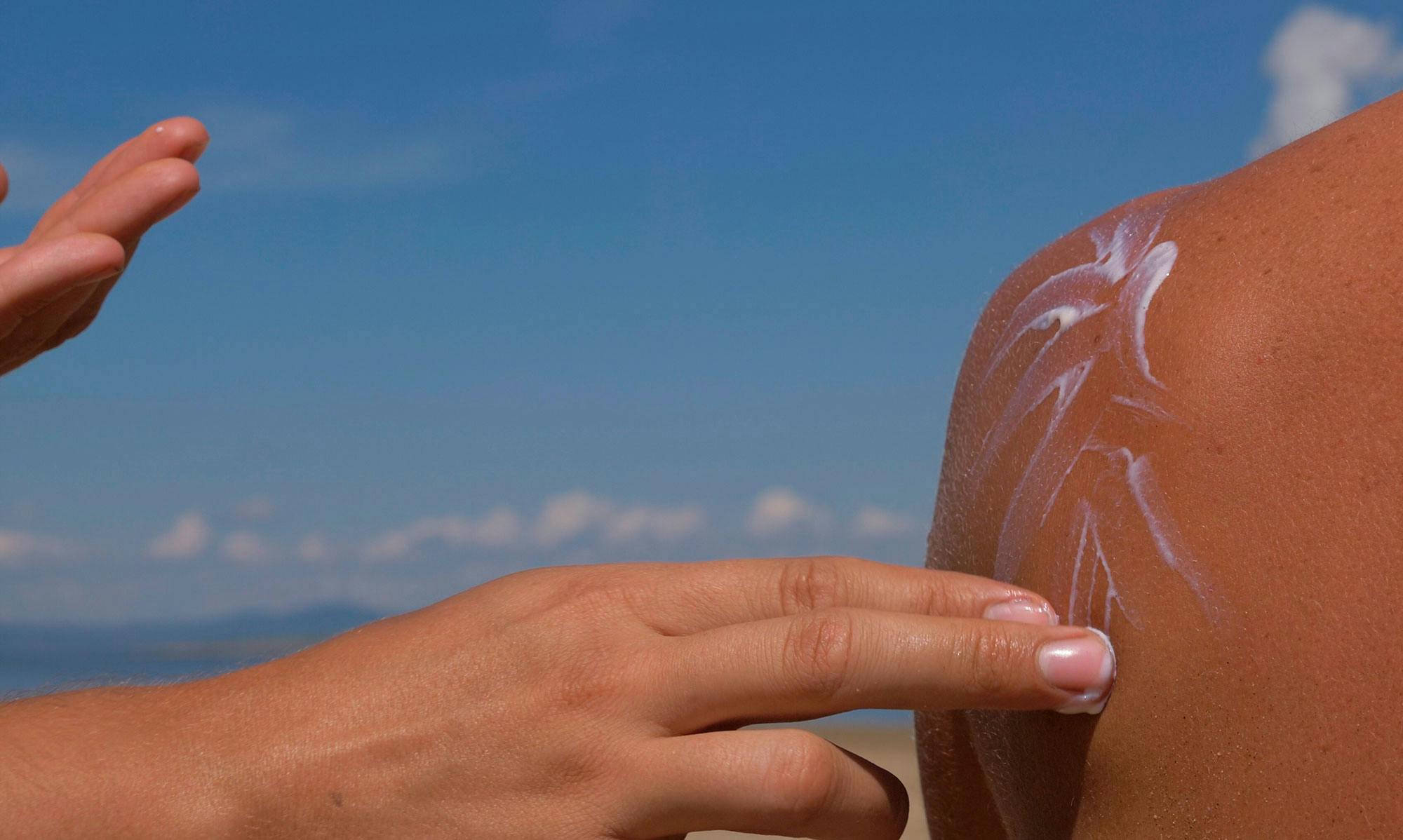 Hender som smører solkrem på en rygg