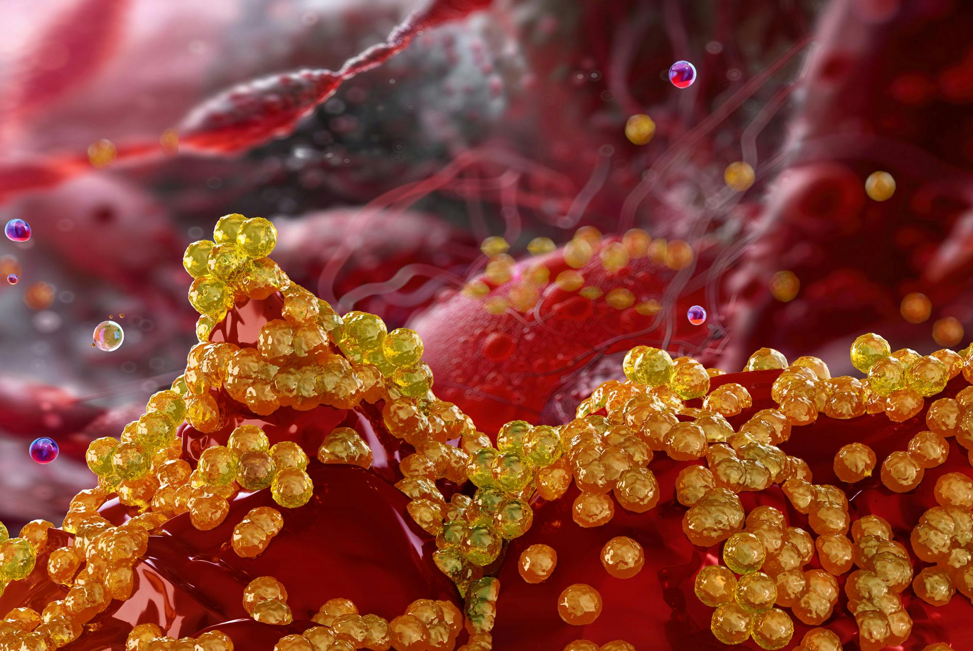 Stafylokokker forårsaker forhøyede infeksjonsrater