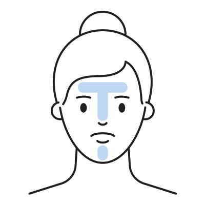 Illustration av T-zonen.