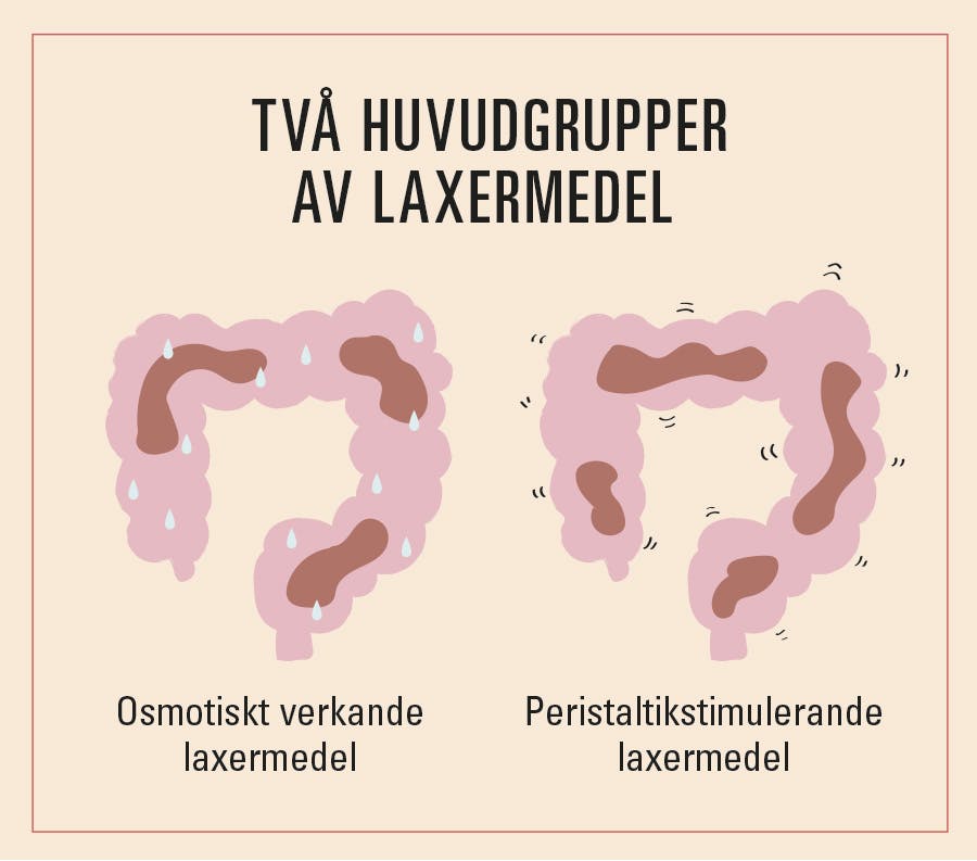 Illustration av laxermedel, mjukgörande och tarmretande