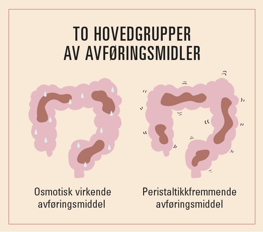 Illustrasjon av avføringsmiddel, osmotisk og peristaltikkfremmende