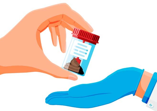 Illustrasjon av avføringsprøve som avleveres til lege