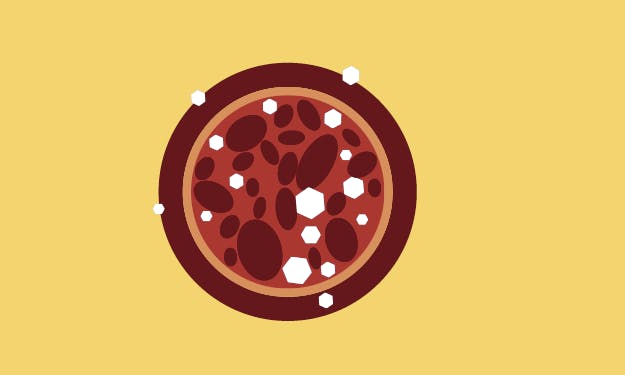 Grafik over blodsukker under motion