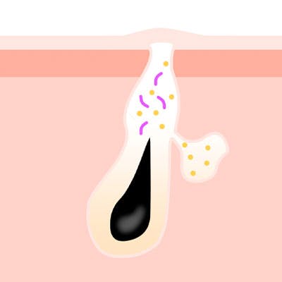 illustration av pormask