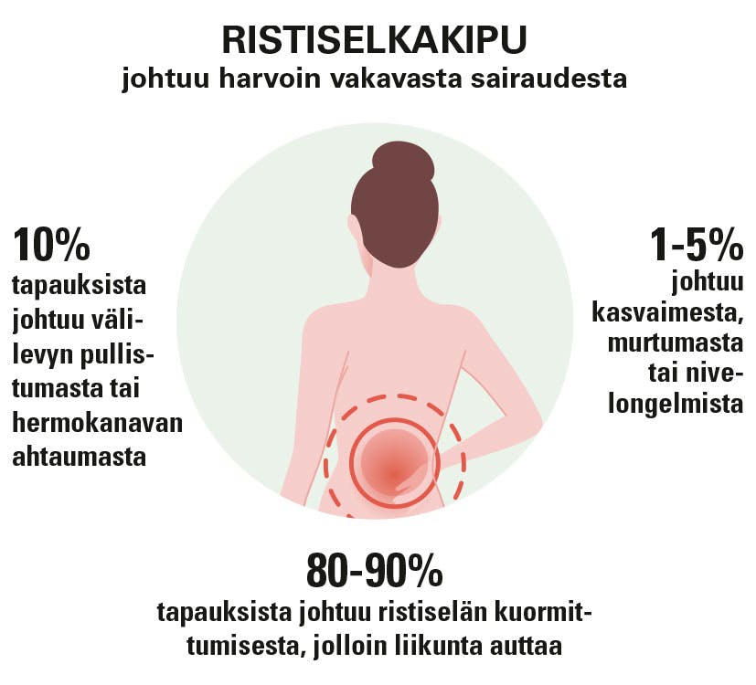 Syitä alaselkäkipuun jaoteltuna ryhmiin