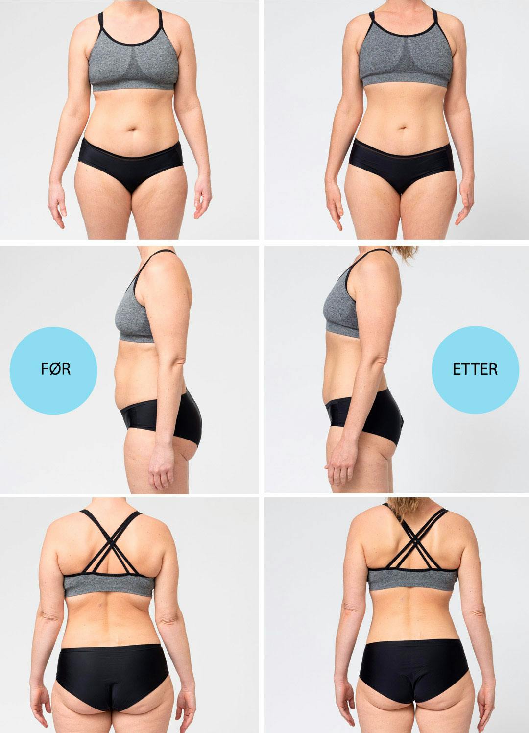 Før og etter, side om side, case Christina.