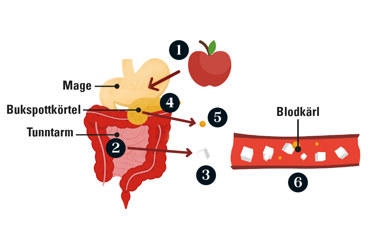 grafik som visar vad som händer i kroppen hos en patient med typ 2-diabetes