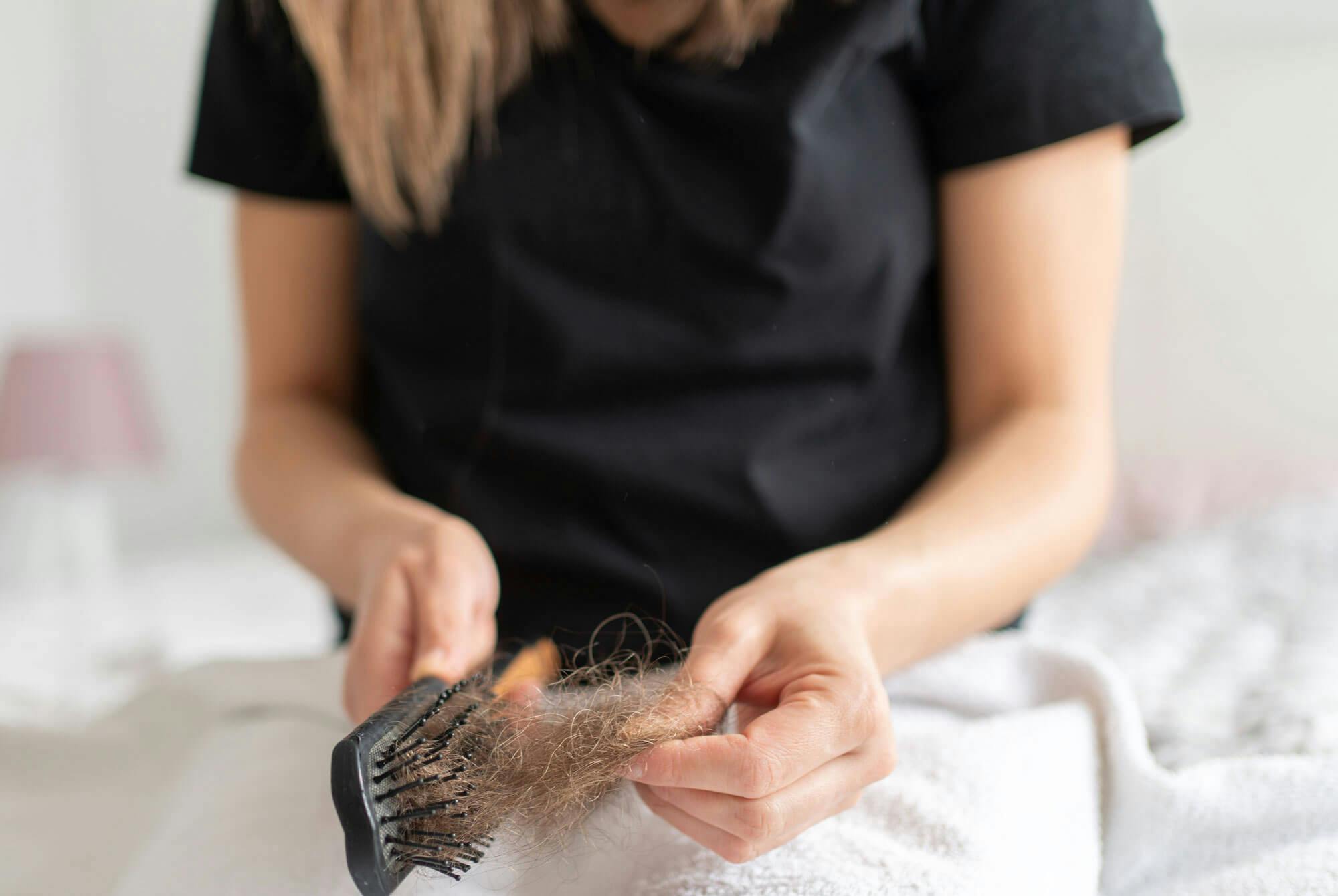 Kvinna tappar håret på grund av wegovy