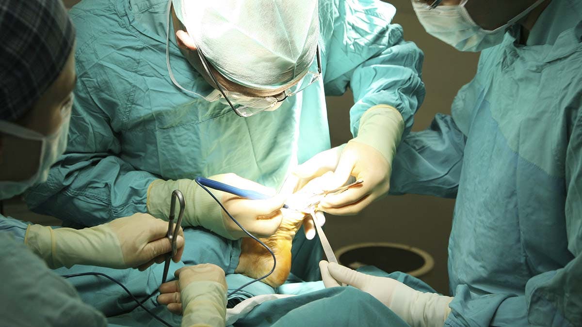 Operation på hammertå