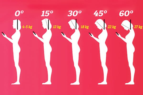 Figur over hodevekt ved ulike hodeposisjoner.