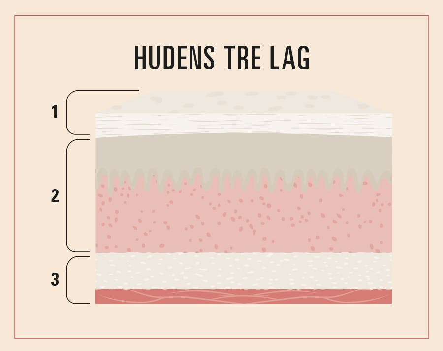 illustration viser hudens tre lag
