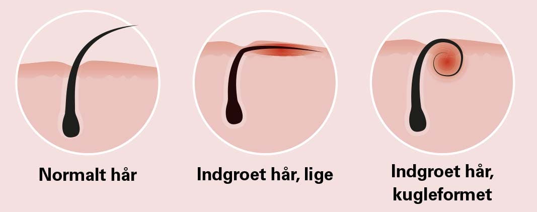 Grafik af tre slags hår