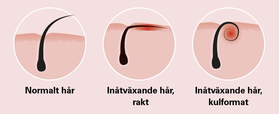 Grafik med tre sorters hårstrån