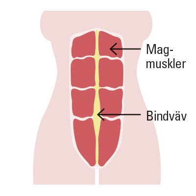 Illustration av vanlig mage