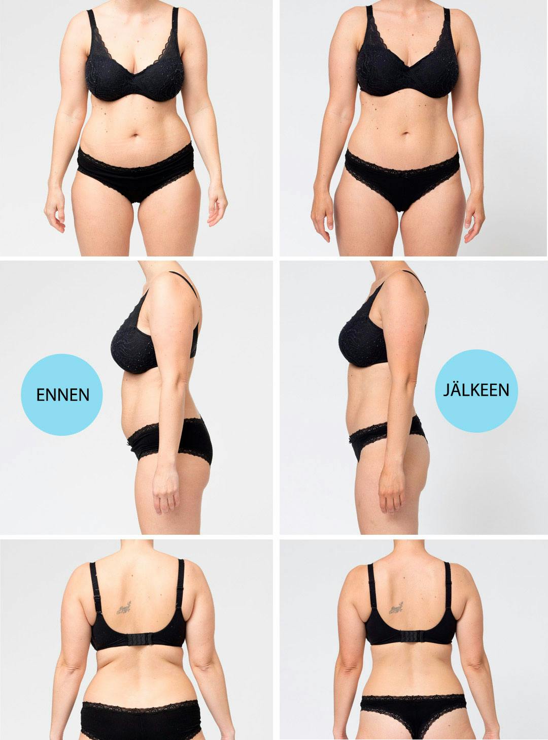 Case Maria ennen ja jälkeen -kuvat