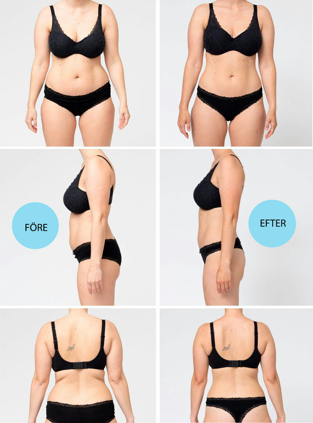 Före och efterbilder av Maria