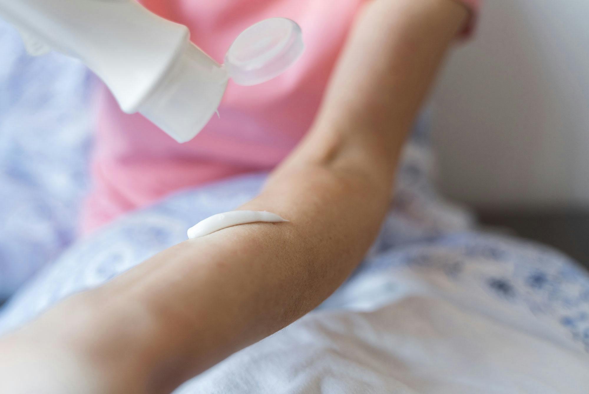 kvinde smører progesteron creme (apotek) på armen